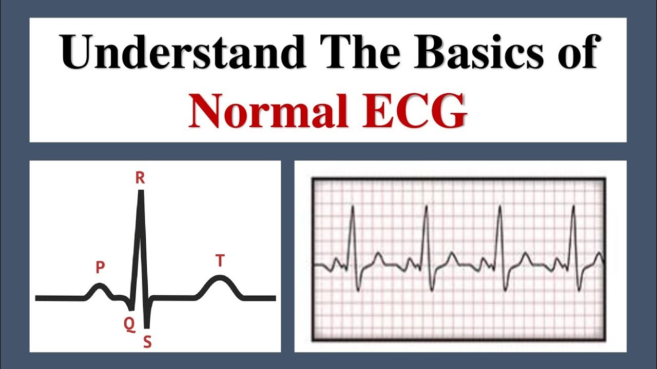 Basics of ECG