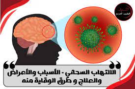 الحمى الشوكية Meningitis